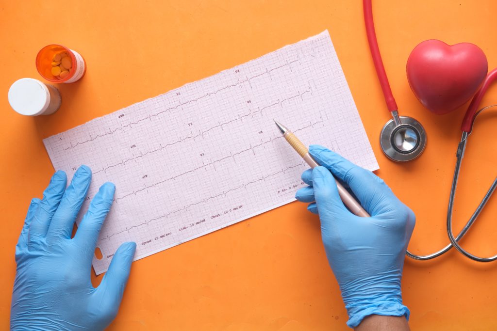 Mostrar un electrocardiograma para un blog de medicina escrito por el galeno virtual